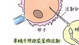 一次三代试管婴儿费用解析：投资与回报的全景考量