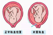 排卵障碍不容忽视，不孕大多是其原因！胡杨河市哪家医院擅长排卵障碍试管方案？