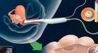 试管一代二代三代哪个更贵？三代试管婴儿的花费需要多少？