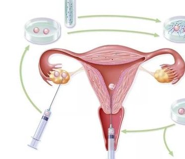 北京三代试管婴儿私立医院怎么选择？你知道你适合什么样的吗？